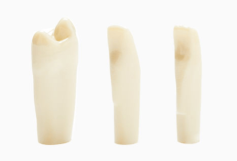 Simulation teeth